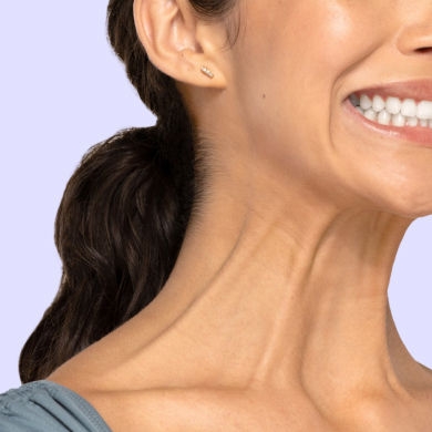 Botox Neck and Jaw example